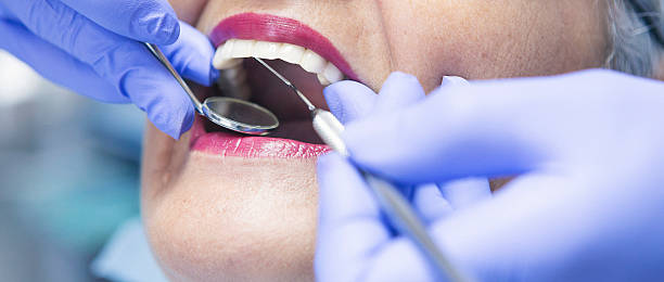 Best Knocked-Out Tooth Emergency  in Shoreacres, TX